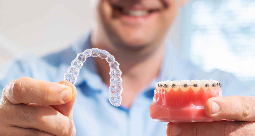 Top 5 Reasons to Choose Invisalign Over Traditional Braces