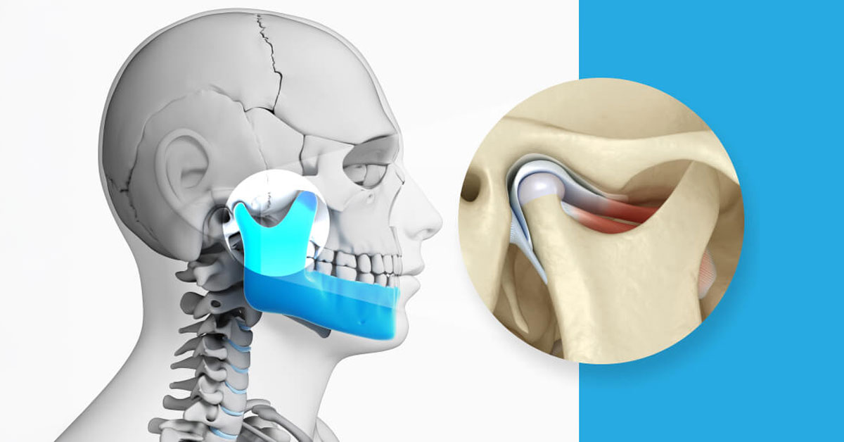 Advanced Maxillofacial Solutions for TMJ, Jaw Pain, and Trauma in Abu Dhabi